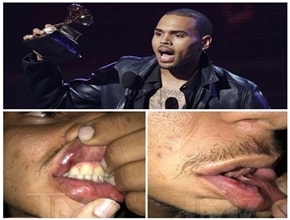 Chris Brown é acusado de agredir fotógrafo